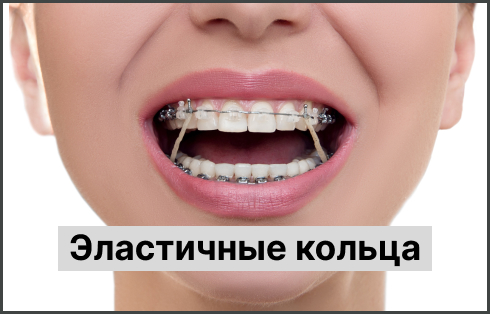 Эластичные кольца